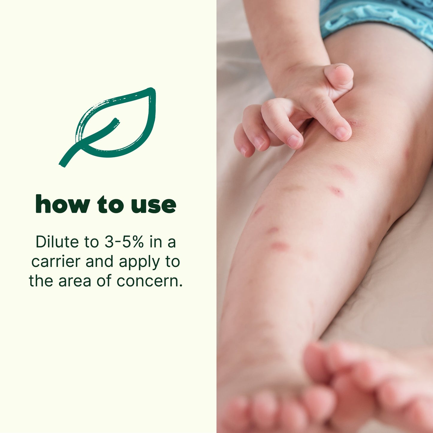 Itch Away Essential Oil Blend