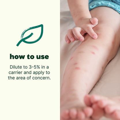 Itch Away Essential Oil Blend